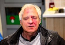 26-01-2019 ΕΓΚΛΗΜΑΤΙΚΗ ΥΠΟΥΛΑ ΣΤΟΧΕΥΜΕΝΗ ΚΑΤΑΔΡΟΜΙΚΗ ΕΠΙΘΕΣΗ ΣΤΗΝ Ε.ΣΥ. ΑΠΟ ΤΟΥΣ ΑΝΤΙΦΑ ΣΤΟΝ ΥΜΗΤΤΟ (VIDEO)