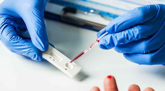 Medicaid:Τα κρούσματα καρκίνου εκτοξεύτηκαν κατά 250% μετά την κυκλοφορία του εμβολίου Covid! Medicaid:-Τα κρούσματα καρκίνου εκτοξεύτηκαν κατά 250% μετά την κυκλοφορία του εμβολίου Covid!