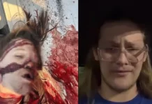 Μέλος των ANTIFA και οπαδός του Μπάιντεν ο στυγνός εκτελεστής Τόμας Μάθιου Κρουκς της Πενσιλβάνιας Στην φωτογραφία απεικονίζεται ο Τόμας Μάθιου Κρουκς, όπως ήταν πριν την απόπειρα δολοφονίας στα δεξιά και πως κατέληξε μετά την απόπειρα στα αριστερά.