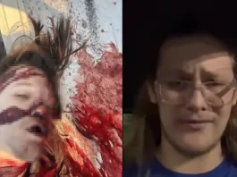 Στην φωτογραφία απεικονίζεται ο Τόμας Μάθιου Κρουκς, όπως ήταν πριν την απόπειρα δολοφονίας στα δεξιά και πως κατέληξε μετά την απόπειρα στα αριστερά.