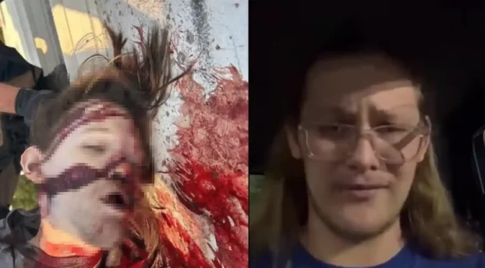 Μέλος των ANTIFA και οπαδός του Μπάιντεν ο στυγνός εκτελεστής Τόμας Μάθιου Κρουκς της Πενσιλβάνιας Στην φωτογραφία απεικονίζεται ο Τόμας Μάθιου Κρουκς, όπως ήταν πριν την απόπειρα δολοφονίας στα δεξιά και πως κατέληξε μετά την απόπειρα στα αριστερά.