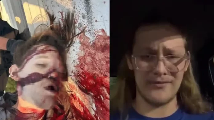 sosANTIFA_result Στην φωτογραφία απεικονίζεται ο Τόμας Μάθιου Κρουκς, όπως ήταν πριν την απόπειρα δολοφονίας στα δεξιά και πως κατέληξε μετά την απόπειρα στα αριστερά.