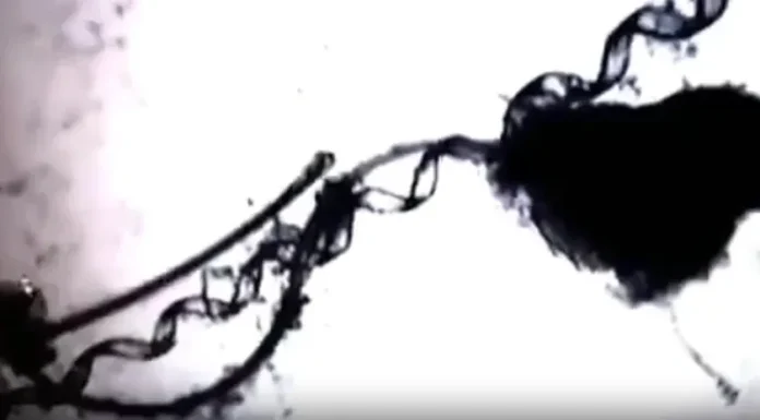 Νανορομπότ βρέθηκαν να αναπτύσσονται στο σπέρμα “εμβολιασμένων” χρόνια μετά την πειραματική ένεση Pfizer & Moderna! (βίντεο) Νανορομπότ βρέθηκαν να αναπτύσσονται στο σπέρμα “εμβολιασμένων” χρόνια μετά την πειραματική ένεση Pfizer & Moderna! (βίντεο)