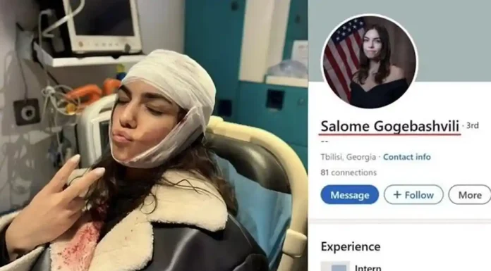 ΓΕΩΡΓΙΑ: ΕΚΤΕΘΕΙΜΈΝΗ η ΧΡΩΜΑΤΙΣΤΉ ΕΠΑΝΆΣΤΑΣΗ Ξενοκίνητη σκηνοθετημένη από ξένες ΜΚΟ (Βίντεο) Το πιο αστείο είναι ότι η viral «φιλελεύθερος διαδηλωτής» που τραυματίστηκε από τη γεωργιανή αστυνομία… εργάζεται κυριολεκτικά για την αμερικανική πρεσβεία.