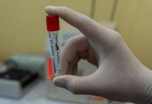 Έρευνα:Τα εμβόλια Covid-19 δεν ήταν ασφαλή ή τουλάχιστον για κάποιους ανθρώπους με συγκεκριμένο γενετικό κώδικα.Σκότωναν ανάλογα με το DNA Έρευνα:Τα εμβόλια Covid-19 δεν ήταν ασφαλή ή τουλάχιστον για κάποιους ανθρώπους με συγκεκριμένο γενετικό κώδικα.Σκότωναν ανάλογα με το DNA!