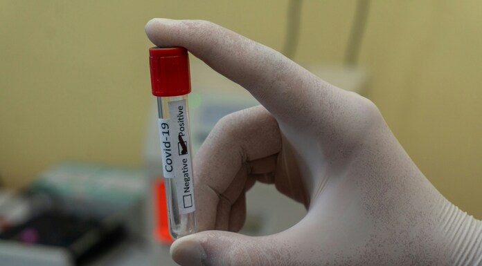 Έρευνα:Τα εμβόλια Covid-19 δεν ήταν ασφαλή ή τουλάχιστον για κάποιους ανθρώπους με συγκεκριμένο γενετικό κώδικα.Σκότωναν ανάλογα με το DNA Έρευνα:Τα εμβόλια Covid-19 δεν ήταν ασφαλή ή τουλάχιστον για κάποιους ανθρώπους με συγκεκριμένο γενετικό κώδικα.Σκότωναν ανάλογα με το DNA!