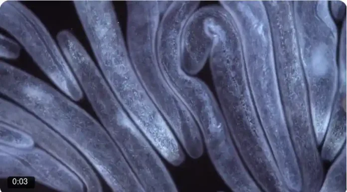 Χρόνια κόπωση, εξανθήματα, ομίχλη εγκεφάλου, φούσκωμα, πιθανότατα είναι από παράσιτα και τι να κάνετε γι ‘αυτό Χρόνια κόπωση εξανθήματα ομίχλη εγκεφάλου πιθανότατα είναι από παράσιτα του οργανισμού και τι να κάνετε γι 'αυτό