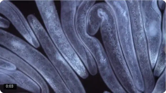 Χρόνια κόπωση εξανθήματα ομίχλη εγκεφάλου πιθανότατα είναι από παράσιτα του οργανισμού και τι να κάνετε γι 'αυτό