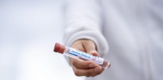 Τα PCR Test δεν πιστοποιούν αν έχεις τον ιό ή όχι
